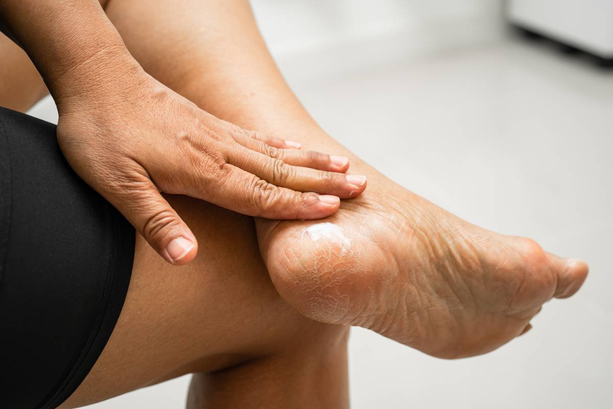 Bol u peti: uzroci, simptomi i rešenja uz anatomske modele obuće